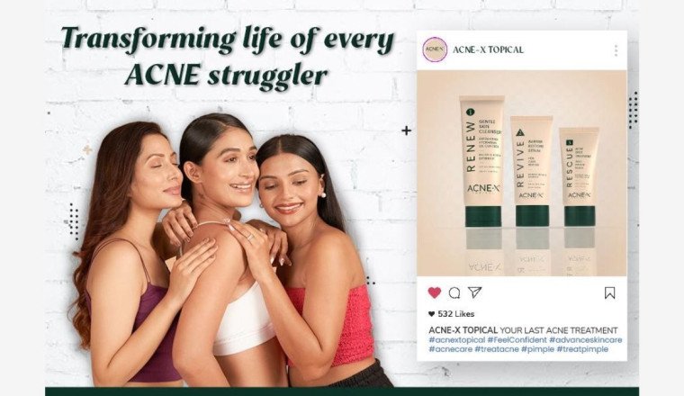 Acne-X Topical: The Skincare Revolution Illuminating the Entertainment World