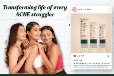 Acne-X Topical: The Skincare Revolution Illuminating the Entertainment World