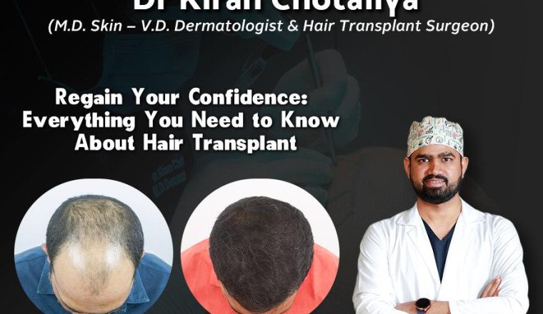Best Hair Transplant in Pune: Dr. Kiran Chotaliya’s Expertise in latest Hair Transplant Technique