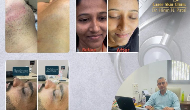 Discover Radiant Skin at Shreeji Laser Skin Clinic in Ahmedabad