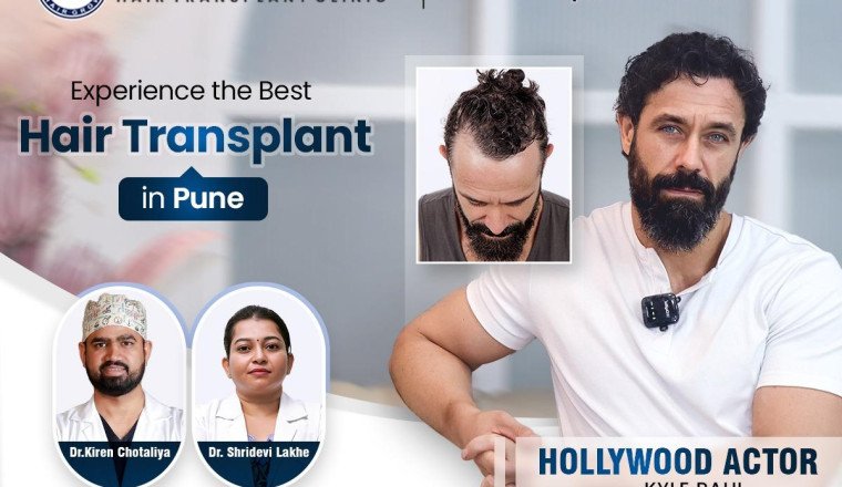 HairFree &amp; HairGrow Leads as Pune’s #1 Choice for Hair Transplants with 100% Success Rate