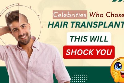 Celebrity Hair Transplant: You’d Never Guess They Had a Hair Transplant- But They Did