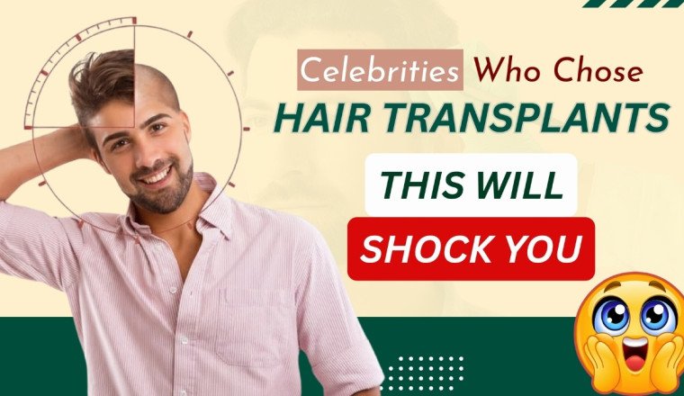 Celebrity Hair Transplant: You’d Never Guess They Had a Hair Transplant- But They Did