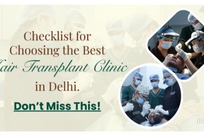 How to Choose the Best Hair Transplant Clinic in Delhi, India?